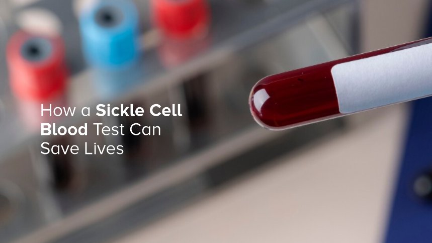 How Sickle Cell Blood Tests Help in Managing the Disease